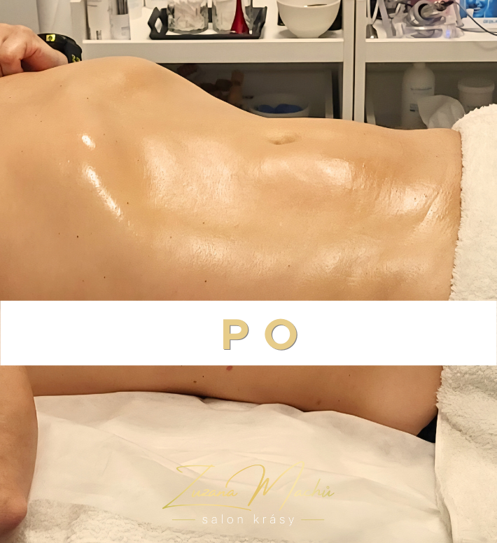 Maderoterapie pro muže po